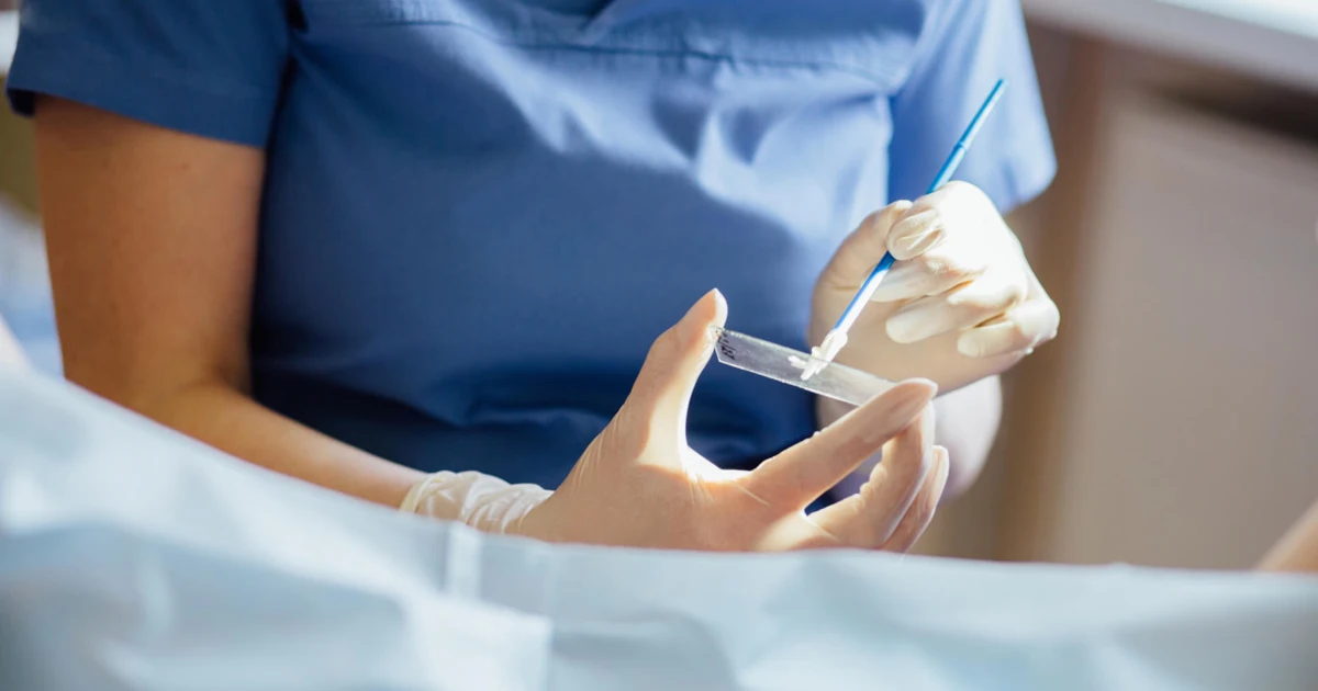 HPV Testi