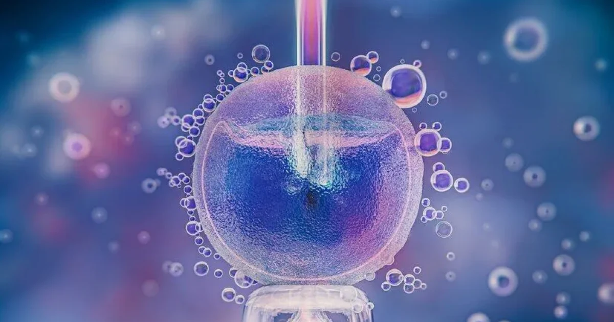 (IVF) İn Vitro Fertilizasyon