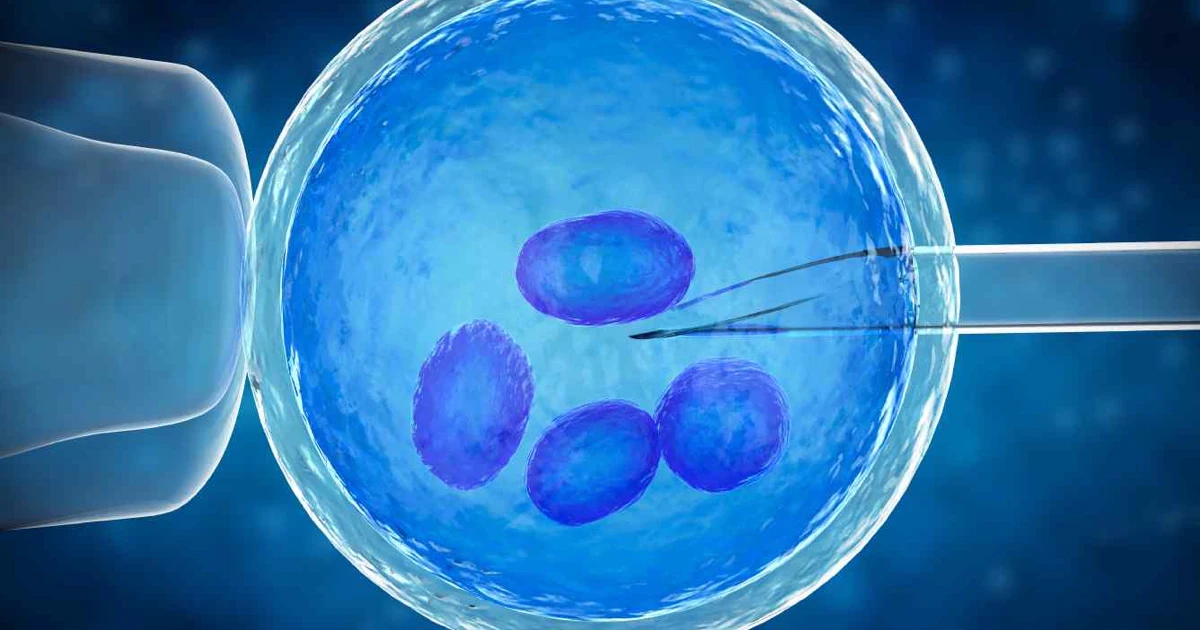 Preimplantasyon Genetik Tanı