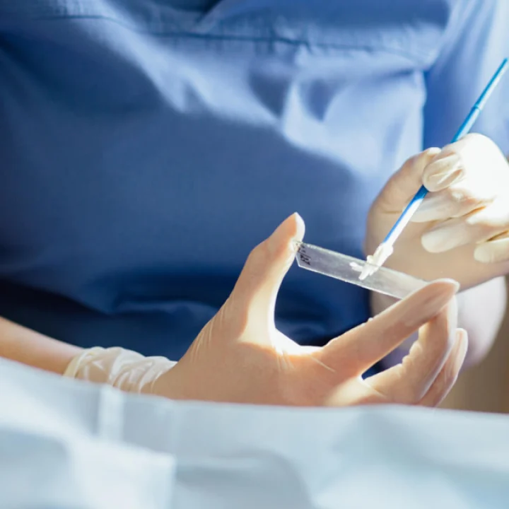 HPV Testi