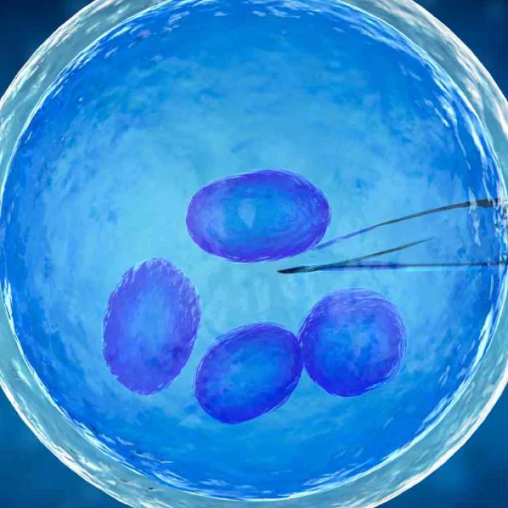 Preimplantasyon Genetik Tanı